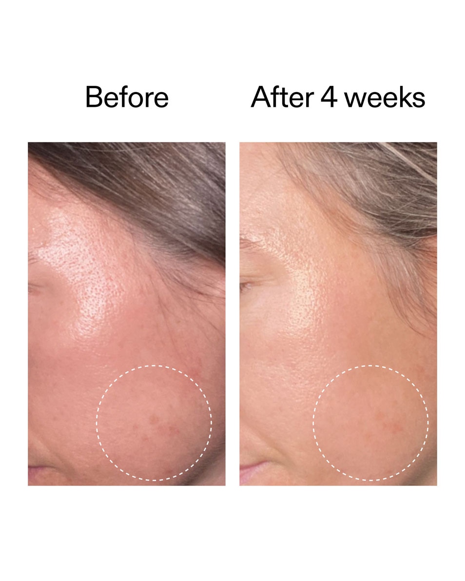 The Inkey List Advanced Retinal Serum Geavanceerd Retinal Serum 15 ML 5