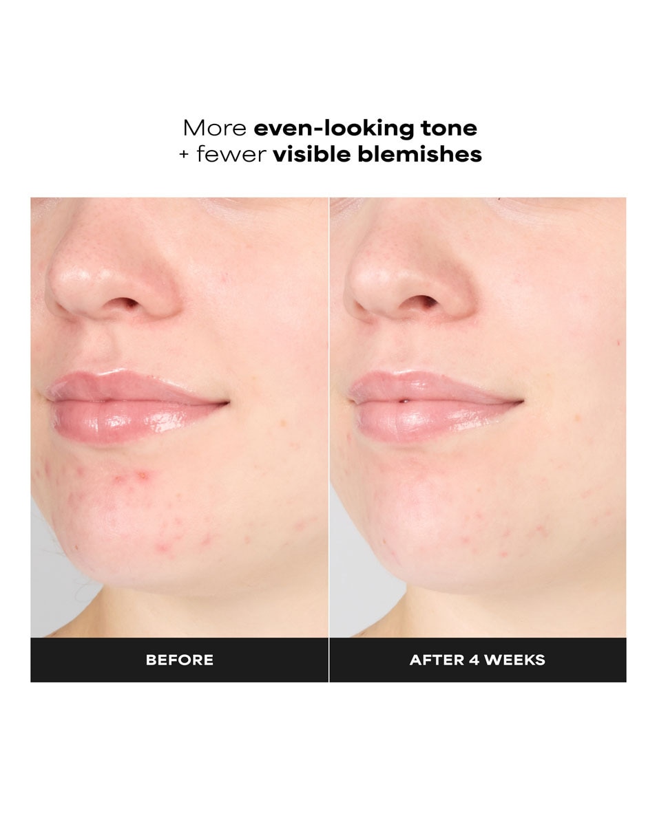 Paula's Choice Sking Perfecting 1% BHA Gentle Exfoliating Gel Toner 100 ML 5