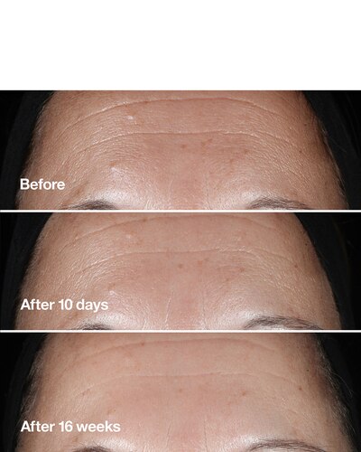 CLINIQUE CLINIQUE SMART CLINICAL REPAIR™ WRINKLE CORRECTING SERUM ANTI-AGING SERUM 30 ML