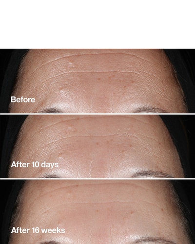 CLINIQUE CLINIQUE SMART CLINICAL REPAIR™ WRINKLE CORRECTING SERUM ANTI-AGING SERUM 50 ML