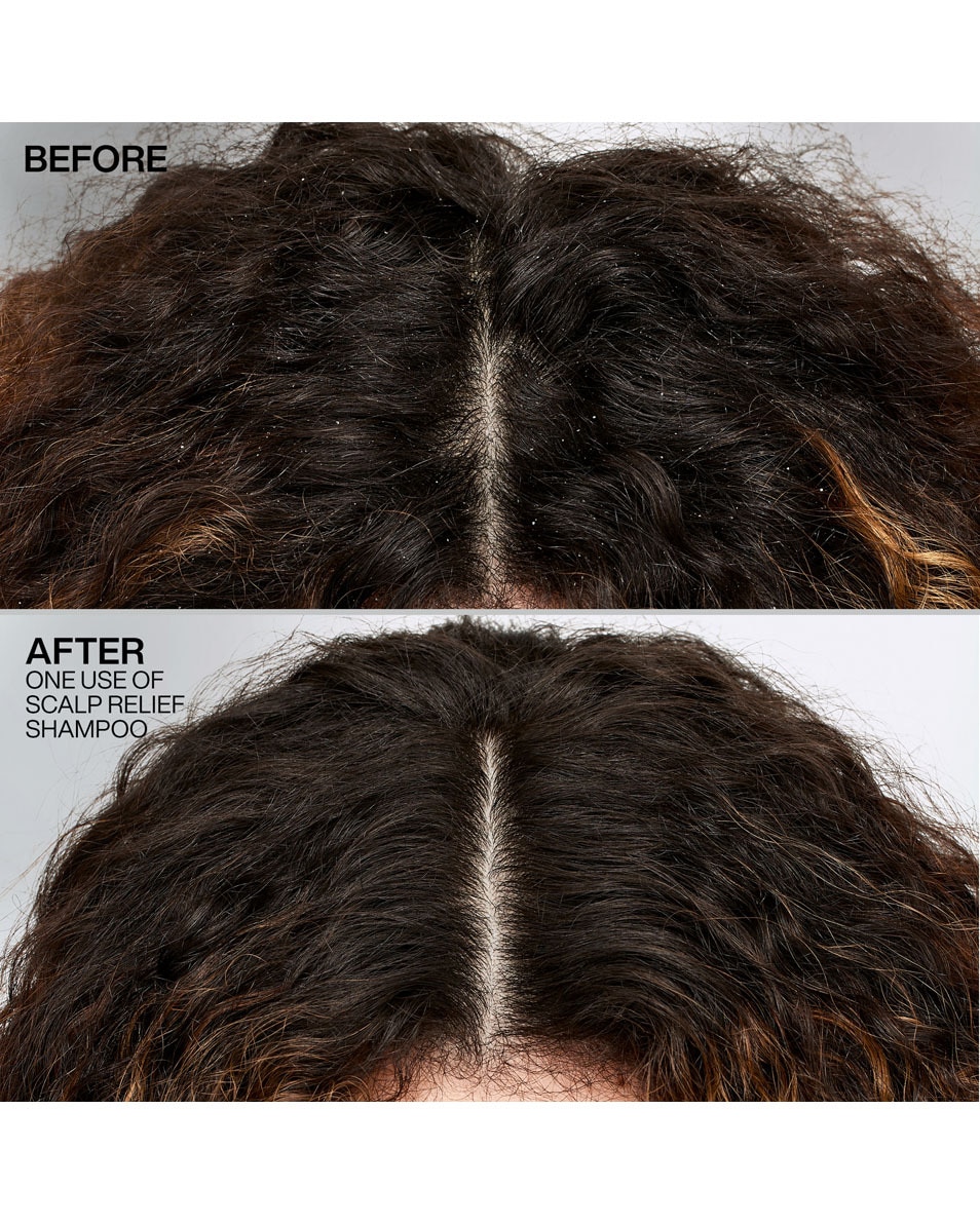 Dandruff shampoo - voor droog haar & een gevoelige hoofdhuid