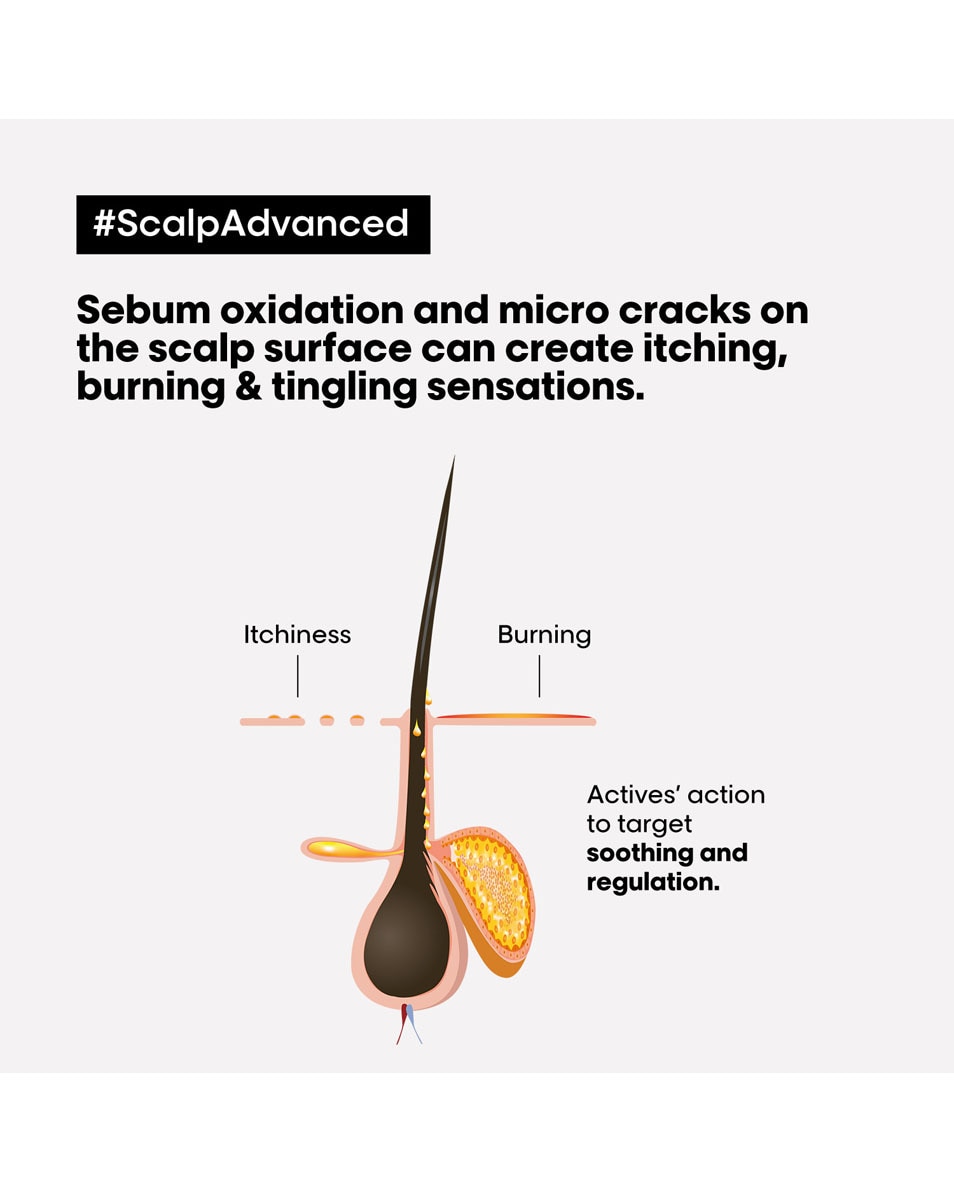 L'OREAL PROFESSIONNEL Scalp Advanced Anti-discomfort treatment 200 ML 2