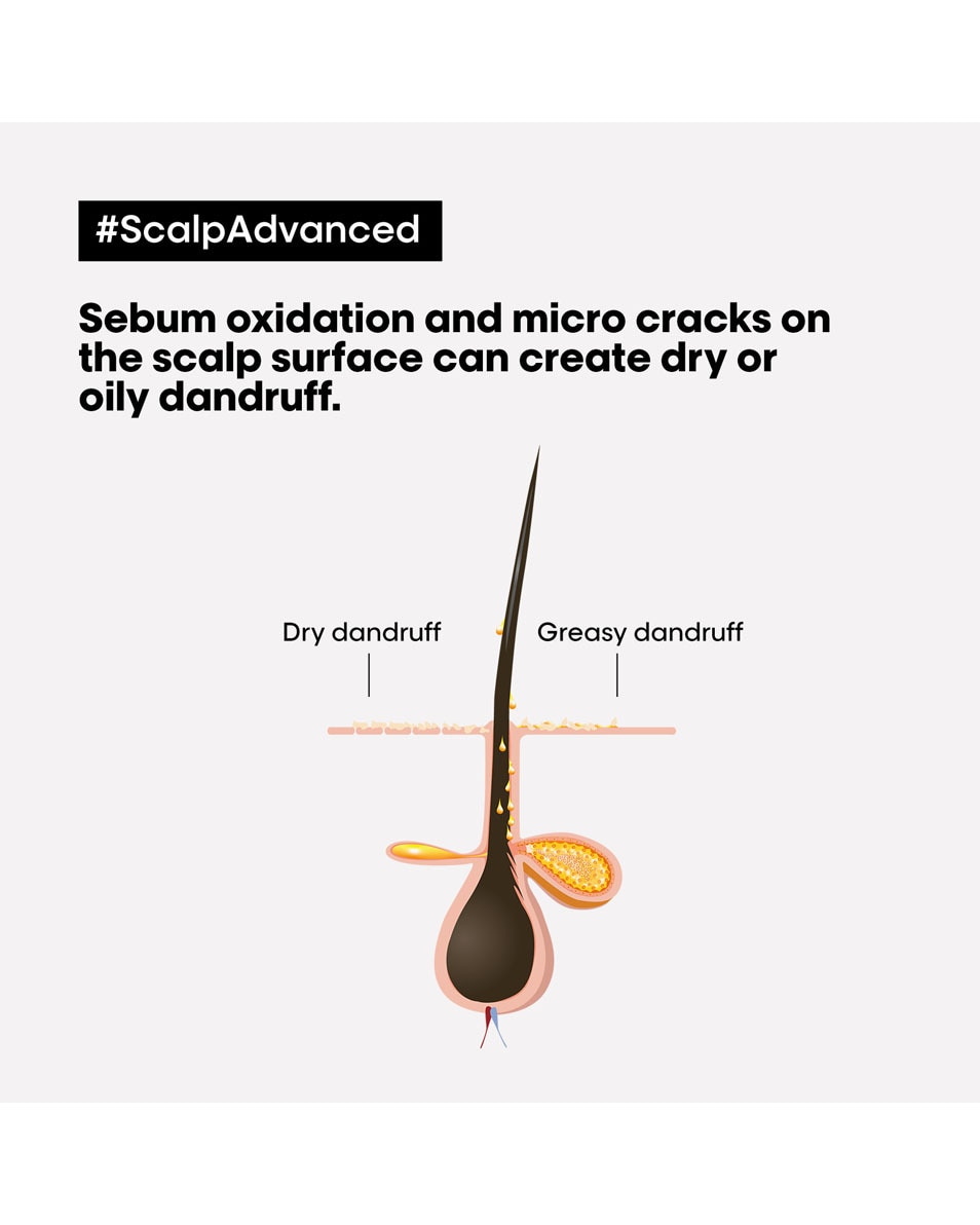 L'OREAL PROFESSIONNEL Scalp Advanced Anti-dandruff dermo-clarifier shampoo 300 ML 2