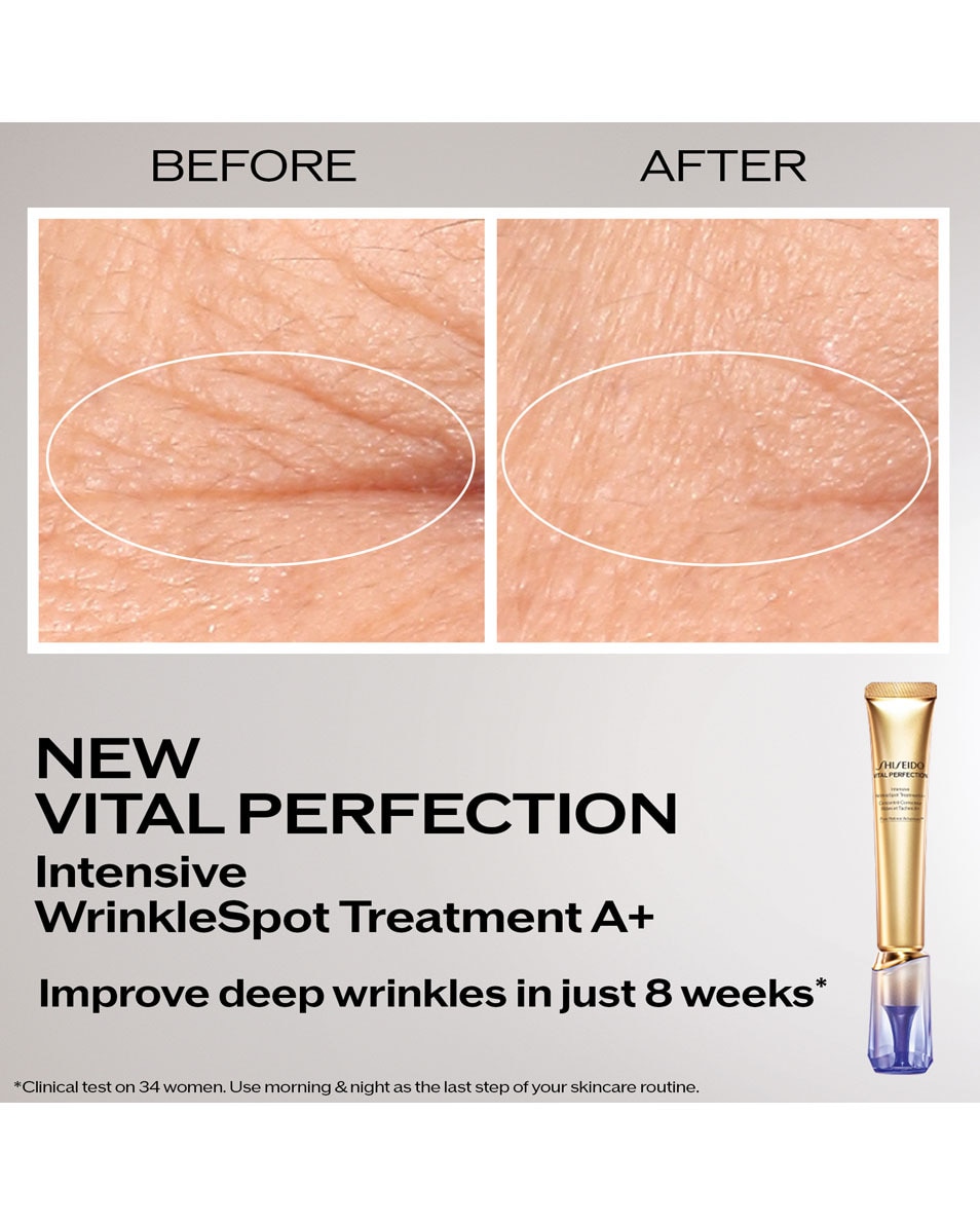 SHISEIDO Vital Perfection Intensive WrinkleSpot Treatment A+ 20 ML